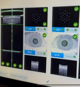 BIOMETRIA ÓPTICA por Swept Source
