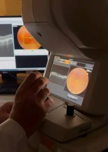 RETINOGRAFIA SIMPLES