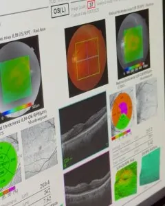 OCT | TOMOGRAFIA DE COERÊNCIA ÓPTICA